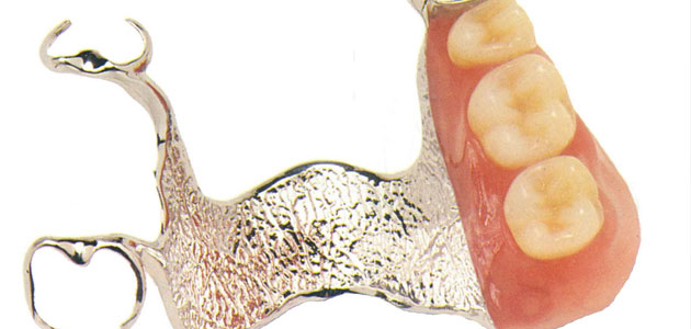 Prothèses dentaires importées